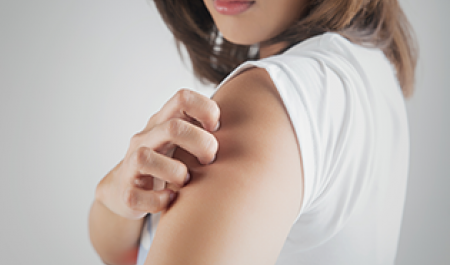 eczema atopique